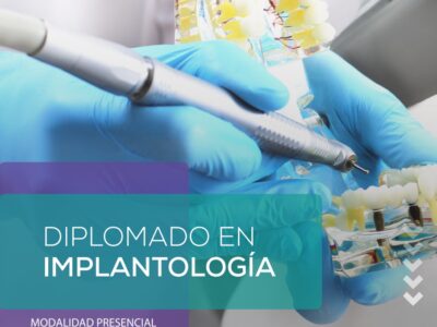 Diplomado en Implantología